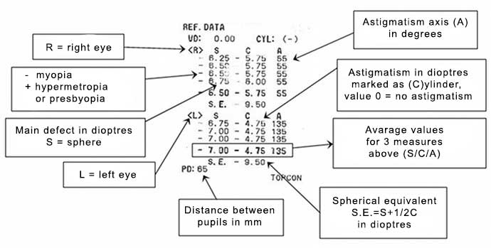 How To Read Eye Exam Chart